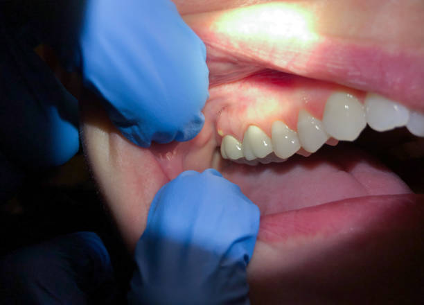 Dentist for Dental Trauma in WV